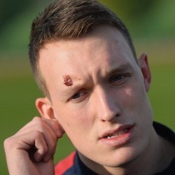 Main Sampai Berlebam dan Cedera, Jones Tak Masalah