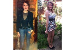 Anggap Semua Makanan Racun karena OCD, Bobot Wanita Ini Tersisa 35 Kg