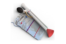 Komplikasi Persalinan Lebih Mudah Teratasi Berkat Alat Temuan Montir Ini