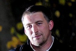 Operasi Tumor Otak 3 Kali Ditunda, Pria Ini Hidup dengan Lubang di Kepala