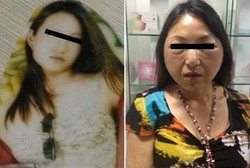 Gara-gara Operasi Plastik Murah, Wajah Gadis Ini Malah Seperti Tante-tante