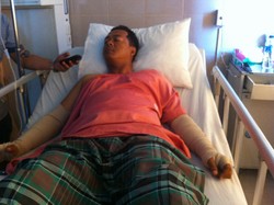 Terluka dan Dirawat di RS, Ini Cerita Korban Soal Perampokan Uang Rp 1 M