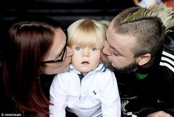 Kena Penyakit Langka, Bocah Ini Selalu Lapar dan Tak Tahu Rasanya Kenyang