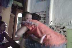 Idap Tumor Mata, Bayi Arbina Harus Bolak-balik Naik KRL ke RSCM