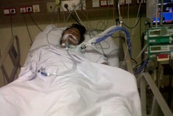 Awalnya Kesemutan Hingga Tak Bisa Naik Motor, Rupanya Remaja Ini Kena GBS