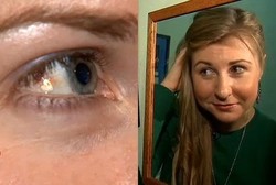 Wah! Wanita Ini Tanam Perhiasan Platinum di Mata Seharga Rp 34 Juta