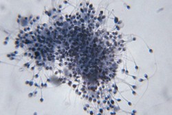 Seluk-beluk Sperma yang Perlu Diketahui