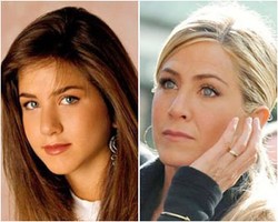 9 Selebriti yang Makin Cantik Pasca Operasi Plastik