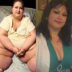 Luar Biasa! Wanita Ini Dulu Beratnya 550 Kg, Kini 180 Kg 