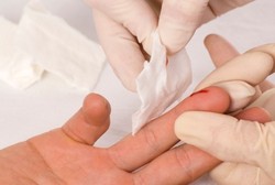 Salah Kaprah, Saat Terluka Jangan Sembarang Pakai Antiseptik