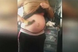 Ingin Menguji Kekuatan Bayi, Wanita Ini Memukuli Perutnya dengan Palu 