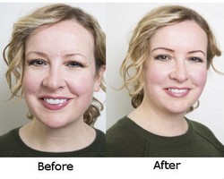 Ekstension Alis, Metode Baru untuk Menebalkan Alis Tipis