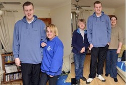 Kelainan Kromosom, Remaja Ini Bisa Jadi Raksasa di Dunia Nyata