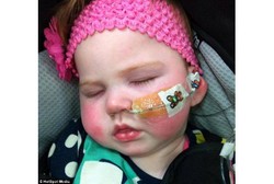 Akibat Kondisi Langka, Balita ini Selalu Lupa Cara Tersenyum