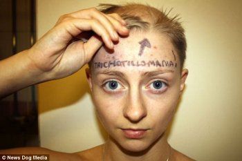 Rebecca Brown, si Cantik Berkepala Botak Penderita Trikotilomania