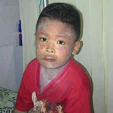 Bocah Diduga Keracunan Obat Diperbolehkan Pulang Usai Tubuhnya Membaik