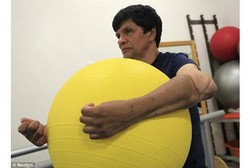 Ini Dia Pasien Latin Pertama yang Dapat Dua Lengan Buatan Baru