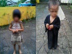 Memprihatinkan, Dua Balita Ini Hidup di Kandang Anjing dan Kerap Disiksa 