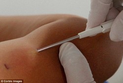 Bikin Kenyang, Tanam Chip Terbaru Ini di Lengan Bisa Bantu Diet