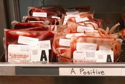 Kesamaan Golongan Darah Bisa Kurangi Penolakan Tubuh Saat Transplantasi