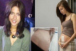 Perut Remaja Ini Membengkak Seperti Hamil dan Terasa Nyeri Tiap Kali Makan