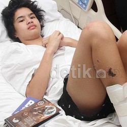 Hii.. Dul Pajang Foto Luka Kecelakaannya
