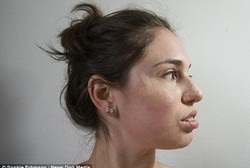 Mengidap Penyakit Langka, Wanita ini Mengacak-acak Kulit Sendiri