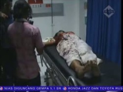 Gara-gara Minta Cerai, Suami Bacok Istri, Mertua dan Adik Ipar