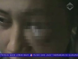Dianiaya Suami Hingga Hampir Buta, Istri Lapor Polisi