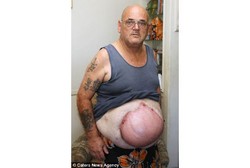 Minum Bir Kaleng yang Jatuh Ke Sungai, Perut Kakek Ini Menggelembung