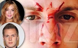 Ayah Lindsay Lohan Bantah Putrinya Terlibat Pemukulan Adik Paris Hilton