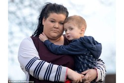 Awalnya Cuma Sembelit, Anak Ini Ternyata Harus Cangkok Jantung