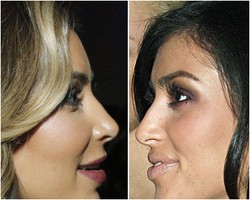 Mengaku Tak Operasi, Ini Perubahan Bentuk Hidung Kim Kardashian