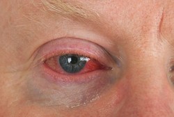 Segera Kunjungi Dokter Mata Jika Anda Temukan 4 Gejala Ini