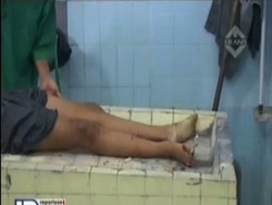 Tragis! 2 Siswi Tewas Ditabrak Kereta, Kondisi Kepala dan Tangan Remuk