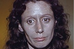 Gara-gara Obat Tetes Hidung, Kulit Wanita Ini Berwarna Perak 