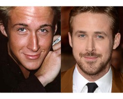 Sebelum Terkenal, Ryan Gosling Diduga Operasi Hidung