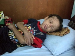 Adit Bocah Penuh Luka Mengaku Bibir dan Lidahnya Digunting Sang Ibu