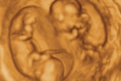 Baru 3 Bulan Hamil, Ibu Ini Melahirkan 10 Bayi di Waktu Bersamaan