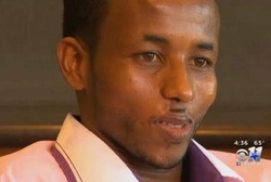 Wajah Digigit Ular, Pria Ini Hidup Tanpa Bibir Atas Selama 20 Tahun