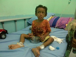 Adit Kini Ditangani Dokter Spesialis Anak dan Psikolog