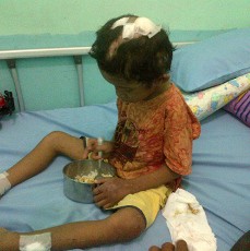 Ibu Tiri: Luka di Kepala Adit karena Jatuh Bukan Dipukul