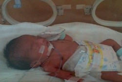 Tolong! Bayi Rafi Butuh Biaya Banyak untuk Bisa Hidup Normal