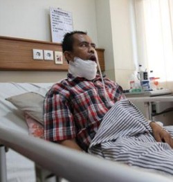 RSHS Berhasil Angkat Tumor Sebesar Bayi dari Rahang Pasien