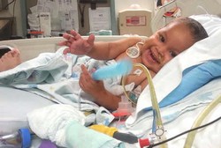 Baru Tiga Tahun, Bocah Ini Sudah Jalani 5 Cangkok Organ Sekaligus