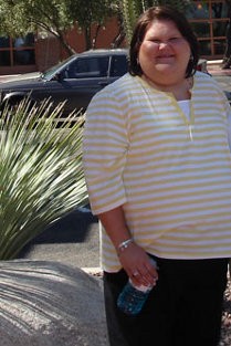 Kebal Insulin karena Kegemukan, Jennifer Berhasil Pangkas Bobot 75 Kg