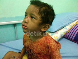 Ibu Kandung: Ibu Tiri Adit Bukan Manusia!