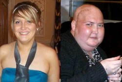 Dikira Sinus, Ternyata Wanita Ini Terkena Tumor Otak Ganas