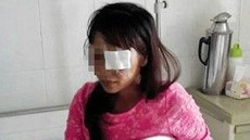 Dibakar Api Cemburu, Pria China Cungkil Mata Istrinya