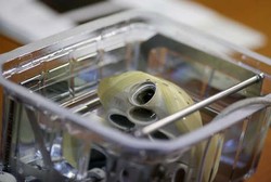 Cangkok Jantung Buatan Pertama di Dunia Berhasil Dilakukan di Prancis